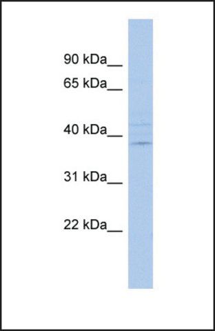 Anti-IQCK antibody produced in rabbit