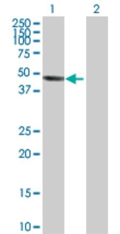 Anti-INPP5A antibody produced in rabbit