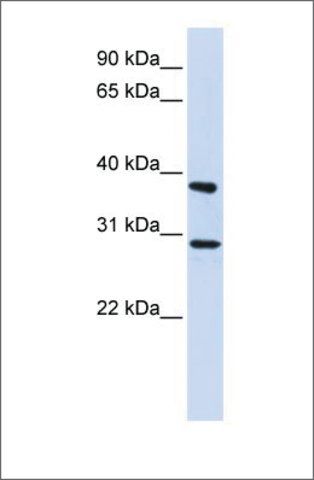 Anti-ING4 antibody produced in rabbit