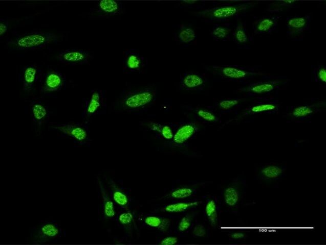 Anti-ING4 antibody produced in rabbit