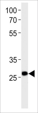 ANTI-IPF(C-TERMINAL) antibody produced in rabbit