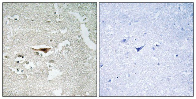 Anti-IPKB antibody produced in rabbit