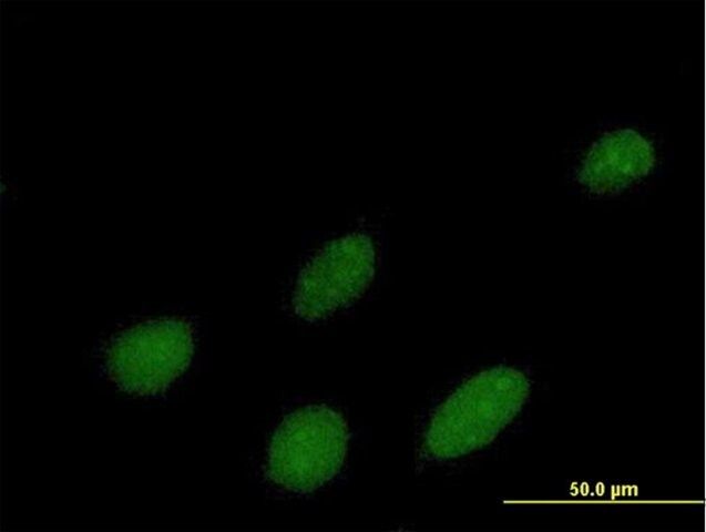 Anti-IPMK antibody produced in mouse