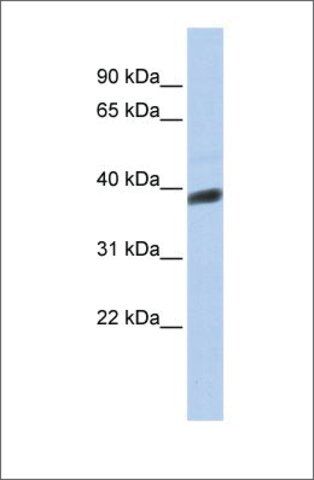 Anti-INSIG1 antibody produced in rabbit