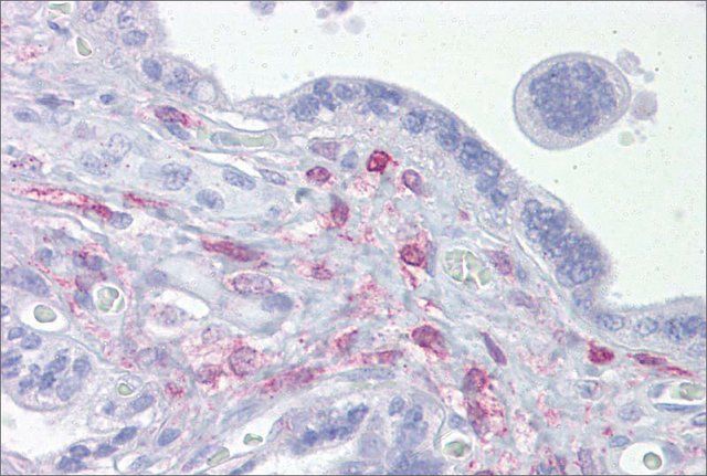 Anti-ING3 (ab1) antibody produced in rabbit