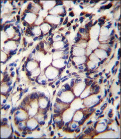 ANTI-IQCA1 (C-TERM) antibody produced in rabbit