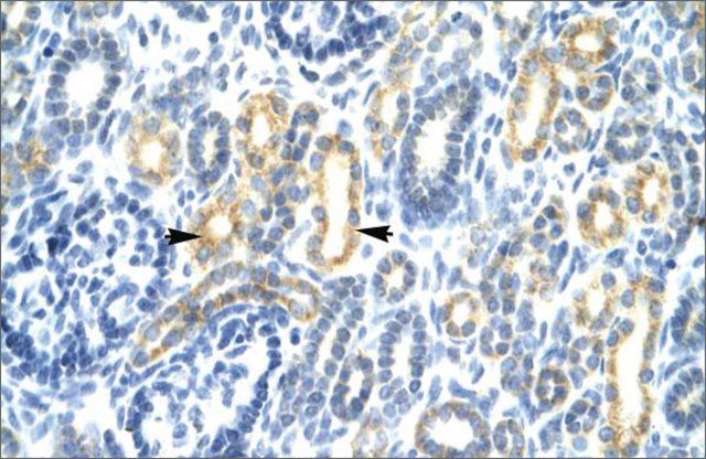 Anti-IRF8 antibody produced in rabbit