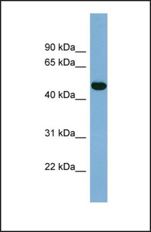 Anti-IRX1 antibody produced in rabbit