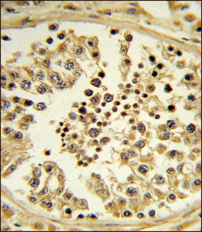 ANTI-IPO11 (N-TERM) antibody produced in rabbit