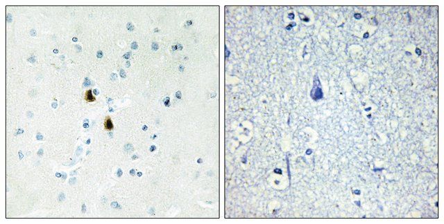 Anti-IPKA antibody produced in rabbit