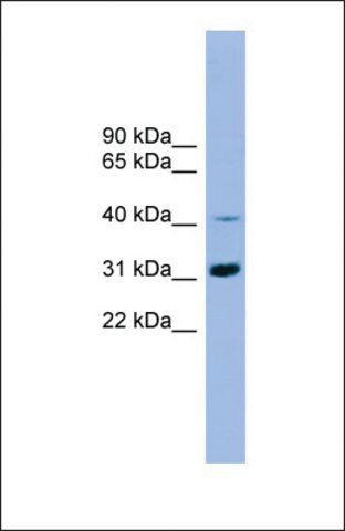 Anti-IQCD antibody produced in rabbit