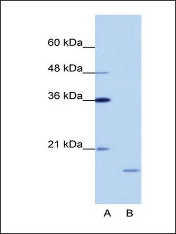 Anti-ISG20 antibody produced in rabbit