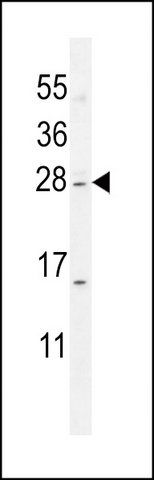 ANTI-IQCF1 (N-TERM) antibody produced in rabbit