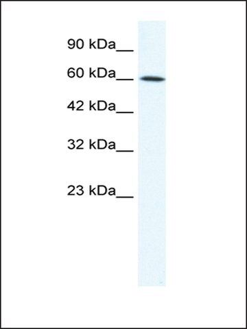 Anti-IRX1 antibody produced in rabbit