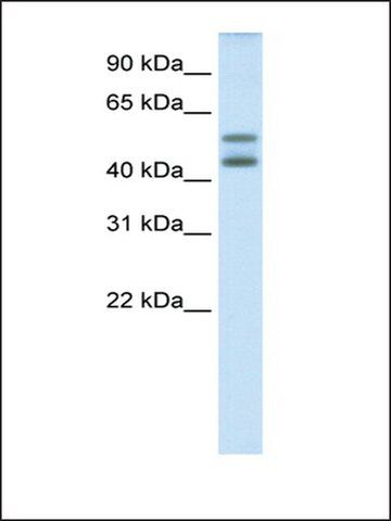 Anti-IRF5 (AB1) antibody produced in rabbit