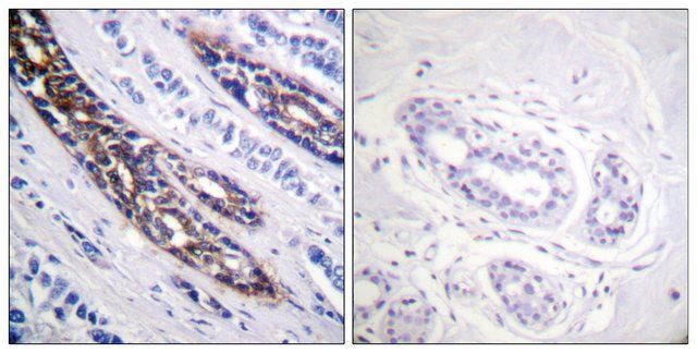 Anti-IRAK1 antibody produced in rabbit