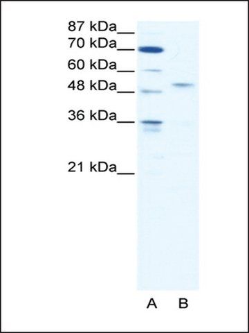 Anti-IRF5 (AB2) antibody produced in rabbit