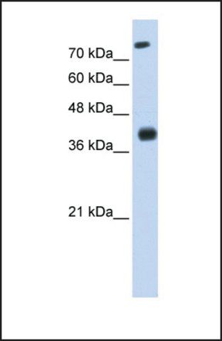 Anti-ISL2, (N-terminal) antibody produced in rabbit