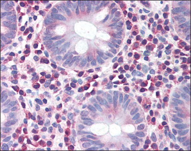 Anti-IRGM antibody produced in rabbit