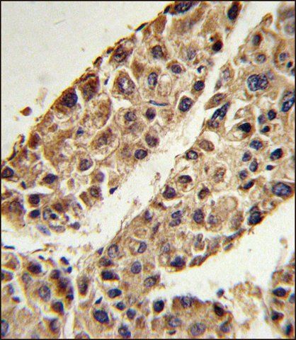 ANTI-ITIH2 (C-TERM) antibody produced in rabbit