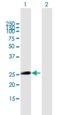 Anti-ITGB1BP3 antibody produced in mouse