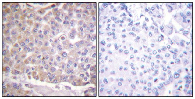 Anti-IRS-1 antibody produced in rabbit