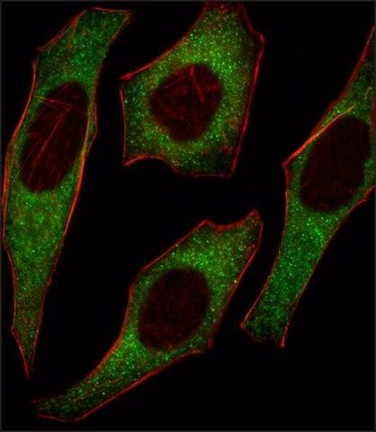 ANTI-IRS2(C-TERMINAL) antibody produced in rabbit