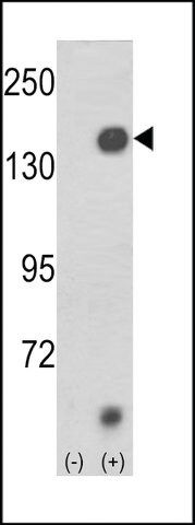 ANTI-JMJD2A(N-TERMINAL) antibody produced in rabbit