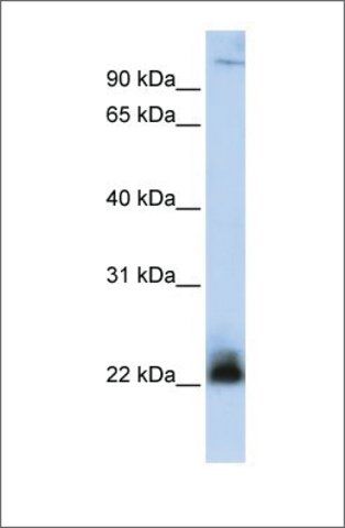 Anti-ITGB3BP antibody produced in rabbit