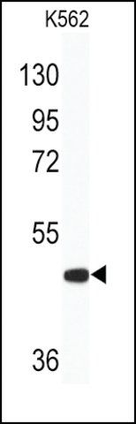 Anti-ITPKA (C-term) antibody produced in rabbit