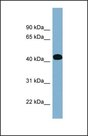 Anti-ITPK1 antibody produced in rabbit