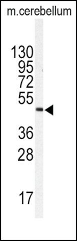 Anti-ITPKA (N-term) antibody produced in rabbit