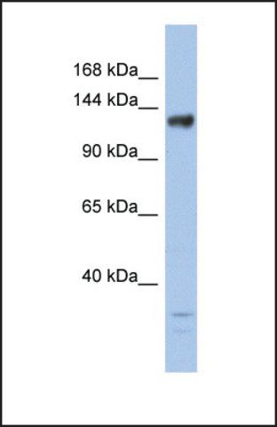 Anti-JMJD2B antibody produced in rabbit