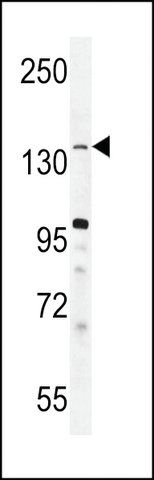 ANTI-JHDM2B(C-TERMINAL) antibody produced in rabbit