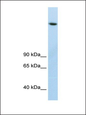 Anti-JMJD1B antibody produced in rabbit