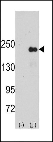 ANTI-JLP (SPAG9) (CENTER) antibody produced in rabbit