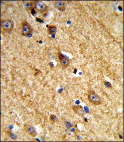 ANTI-JAKMIP1 (CENTER) antibody produced in rabbit