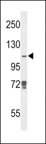 ANTI-JMJD2B(N-TERMINAL) antibody produced in rabbit