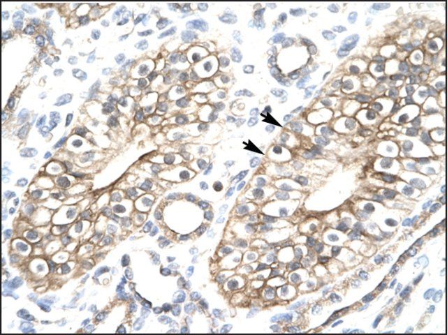 Anti-FLJ11730 antibody produced in rabbit