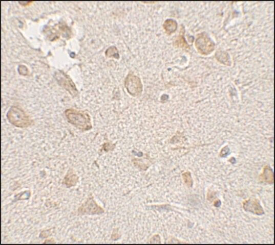 Anti-FMR1 antibody produced in rabbit