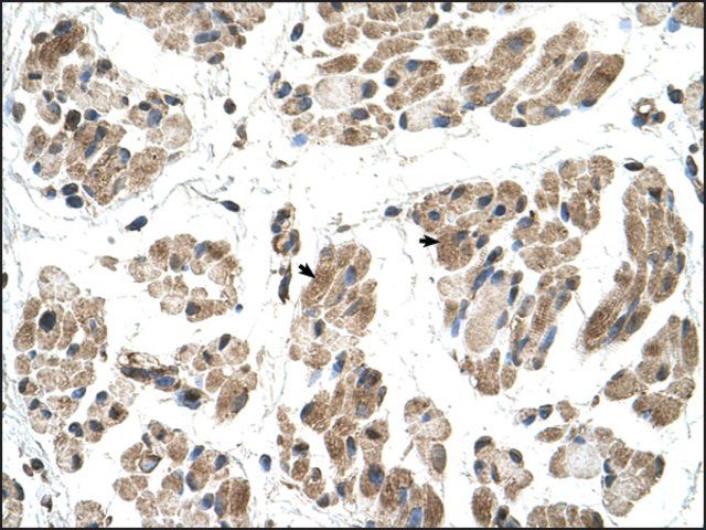 Anti-FKTN antibody produced in rabbit