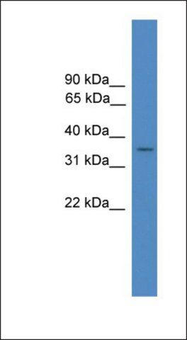 Anti-FLJ36070 antibody produced in rabbit