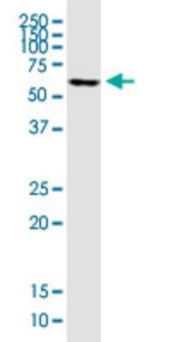 ANTI-FOXC2 antibody produced in mouse