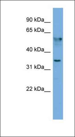 Anti-FNDC8 antibody produced in rabbit