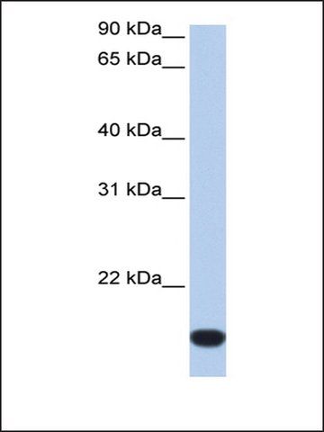 Anti-FLJ44894 antibody produced in rabbit