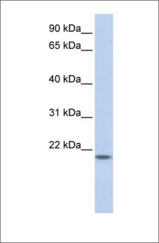 Anti-FLJ33706 antibody produced in rabbit