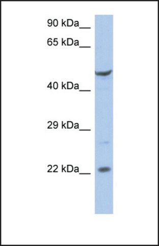 Anti-FLJ44894, (N-terminal) antibody produced in rabbit