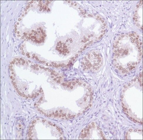 Anti-FOXA1 antibody, Rabbit monoclonal