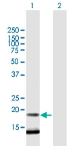 Anti-FLJ38663 antibody produced in mouse