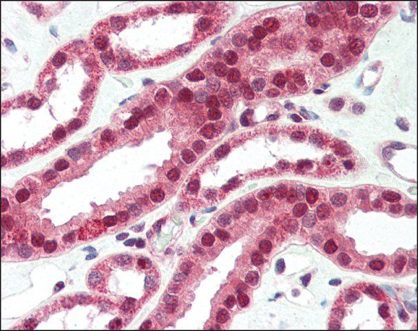 Anti-FNBP1L / TOCA antibody produced in rabbit